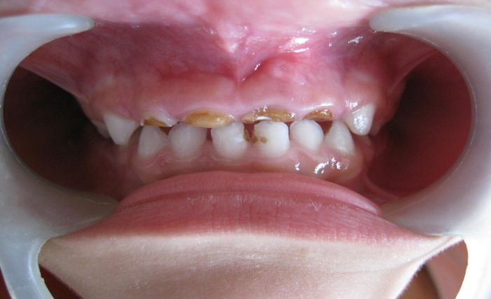 Blog Dr Eduardo Estupiñan Odontologo Ibague Colombia