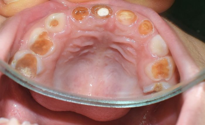 Blog Dr Eduardo Estupiñan Odontologo Ibague Colombia
