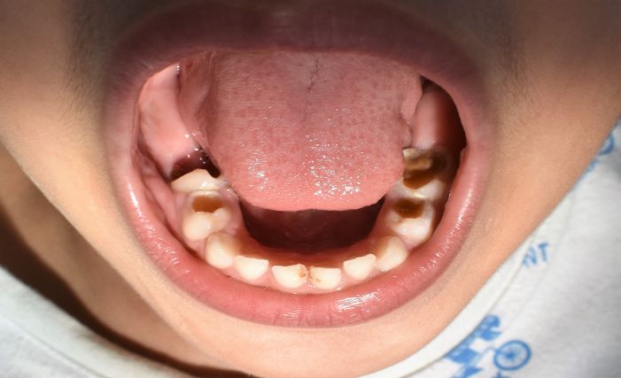 Blog Dr Eduardo Estupiñan Odontologo Ibague Colombia