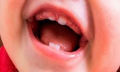 Blog Dr Eduardo Estupiñan Odontologo Ibague Colombia
