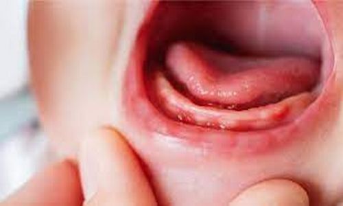 Blog Dr Eduardo Estupiñan Odontologo Ibague Colombia