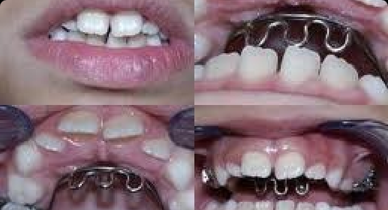 Servicios Dr Eduardo Estupiñan Odontologo Ibague Colombia