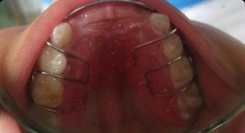 Servicios Dr Eduardo Estupiñan Odontologo Ibague Colombia