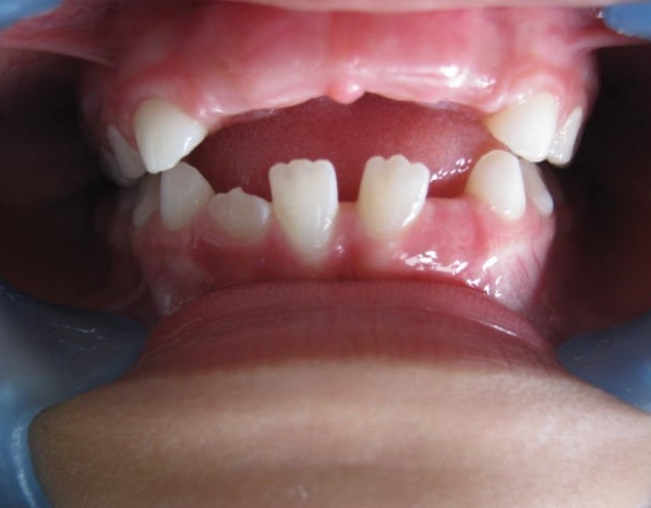 Tratamientos Servicios Dr Eduardo Estupiñan Odontologo Ibague