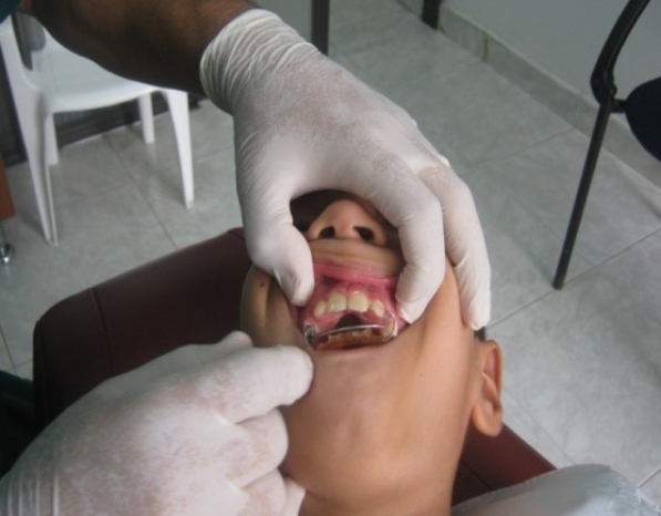 Tratamientos Servicios Dr Eduardo Estupiñan Odontologo Ibague