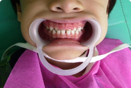 Servicios Dr Eduardo Estupiñan Odontologo Ibague Colombia