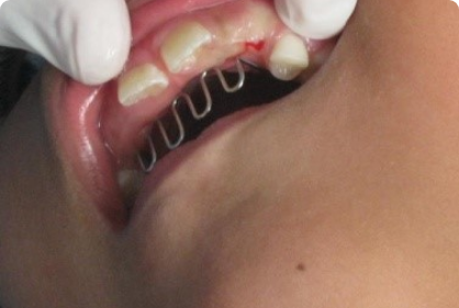 Servicios Dr Eduardo Estupiñan Odontologo Ibague Colombia