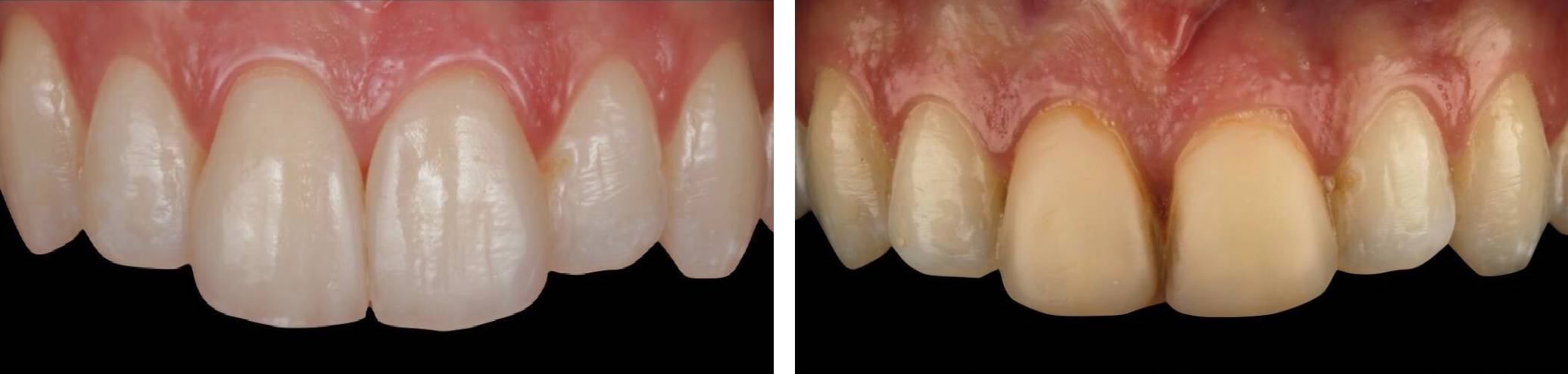 Tratamientos Servicios Dr Eduardo Estupiñan Odontologo Ibague