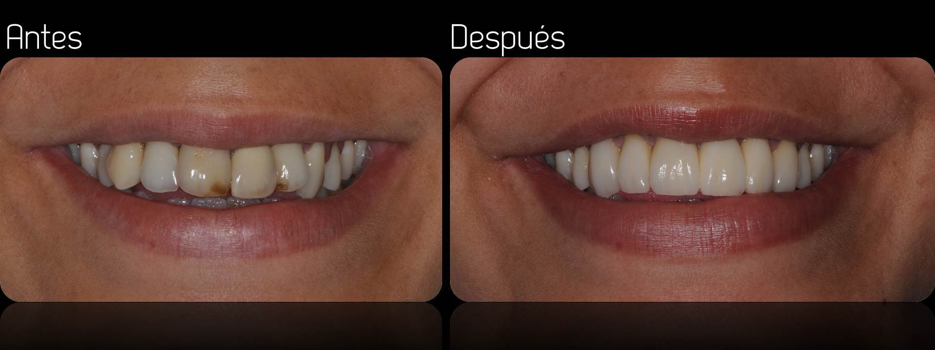 Tratamientos Servicios Dr Eduardo Estupiñan Odontologo Ibague