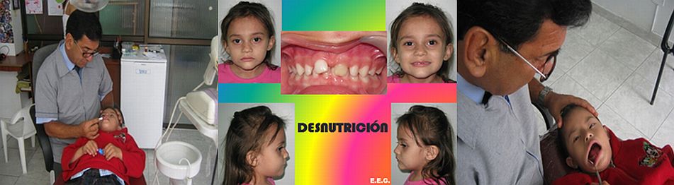 Tratamientos Servicios Dr Eduardo Estupiñan Odontologo Ibague