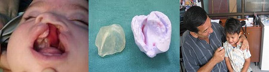 Tratamientos Servicios Dr Eduardo Estupiñan Odontologo Ibague