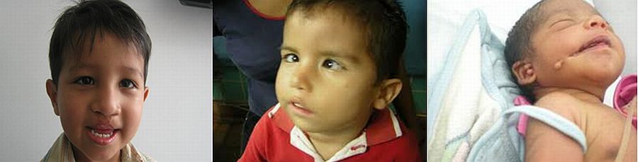 Tratamientos Servicios Dr Eduardo Estupiñan Odontologo Ibague