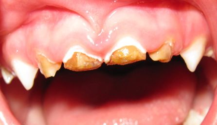 Tratamientos Servicios Dr Eduardo Estupiñan Odontologo Ibague