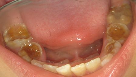 Tratamientos Servicios Dr Eduardo Estupiñan Odontologo Ibague