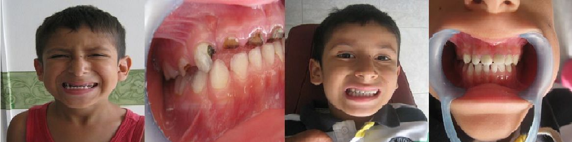 Tratamientos Servicios Dr Eduardo Estupiñan Odontologo Ibague