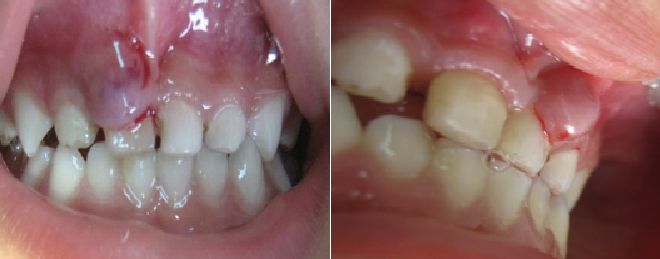 Tratamientos Servicios Dr Eduardo Estupiñan Odontologo Ibague