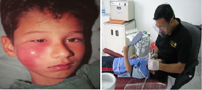 Tratamientos Servicios Dr Eduardo Estupiñan Odontologo Ibague