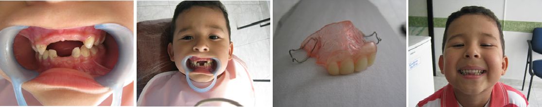 Tratamientos Servicios Dr Eduardo Estupiñan Odontologo Ibague