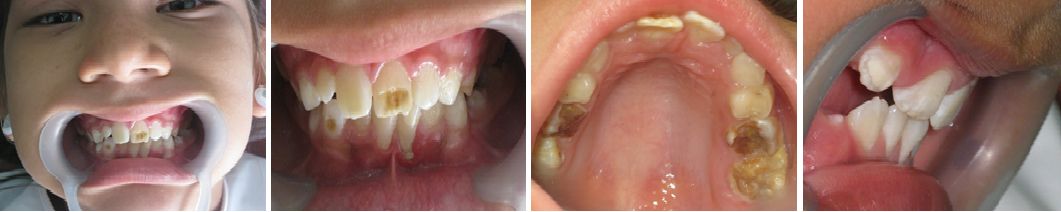 Tratamientos Servicios Dr Eduardo Estupiñan Odontologo Ibague