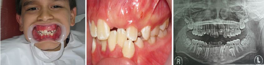 Tratamientos Servicios Dr Eduardo Estupiñan Odontologo Ibague