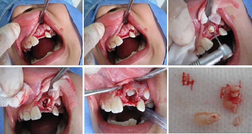 Tratamientos Servicios Dr Eduardo Estupiñan Odontologo Ibague