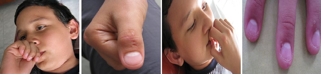 Tratamientos Servicios Dr Eduardo Estupiñan Odontologo Ibague