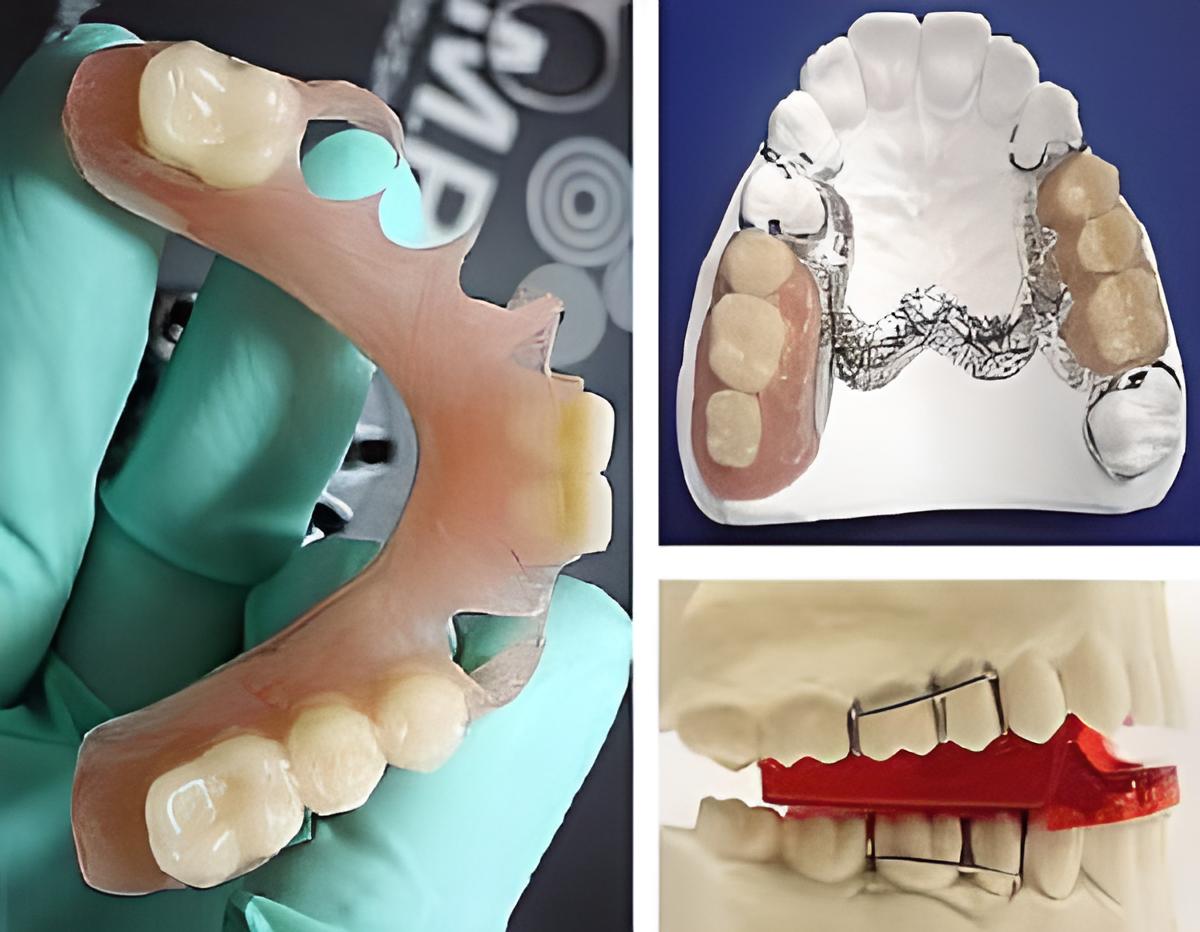 Tratamientos Servicios Dr Eduardo Estupiñan Odontologo Ibague