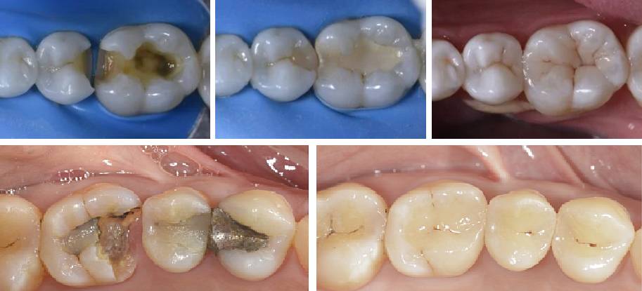 Tratamientos Servicios Dr Eduardo Estupiñan Odontologo Ibague