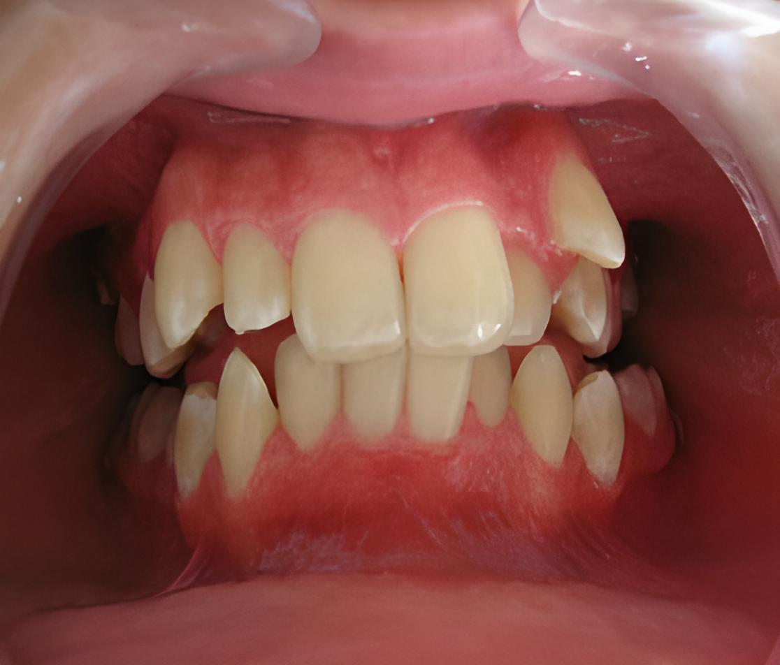 Tratamientos Servicios Dr Eduardo Estupiñan Odontologo Ibague